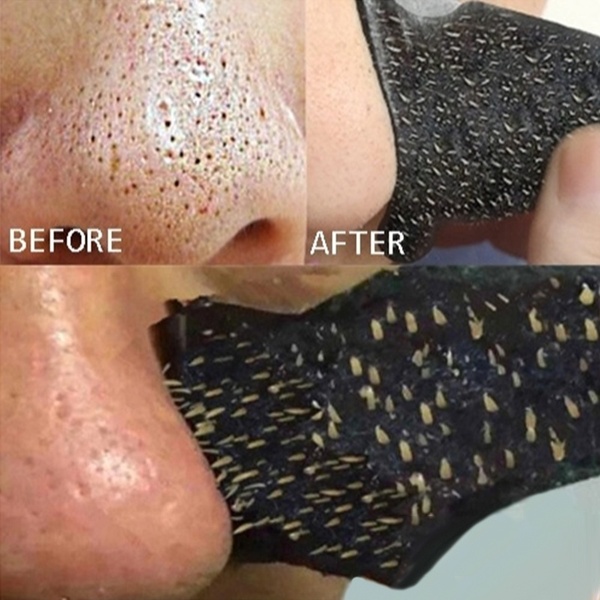 ESPINHA 10pcs cravo remoção de acne adesivos fortes nariz cravo cravo limpeza limpador FRETE GRATIS